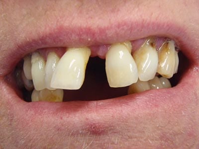 Case Study - Jacky before her treatment