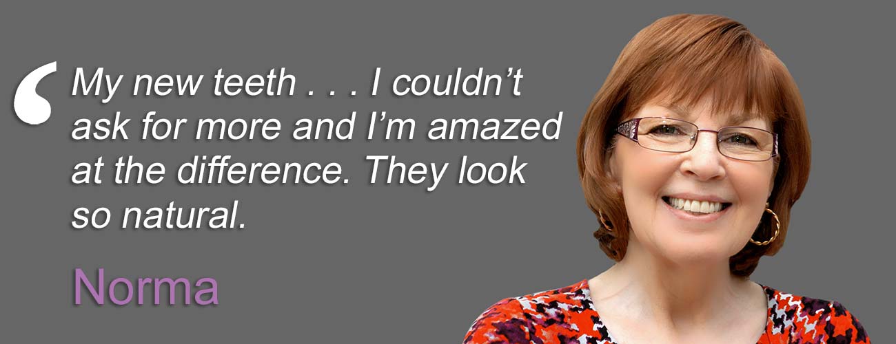 Case Study - Norma quote