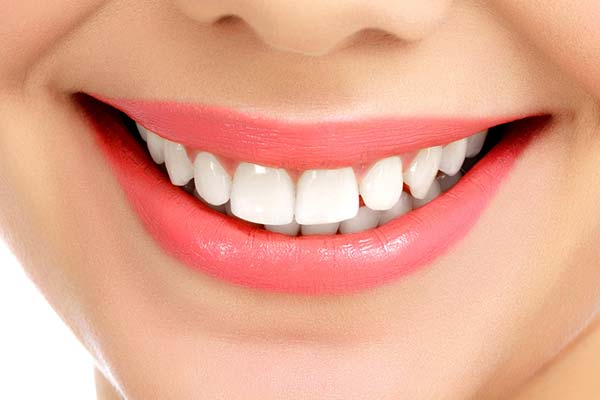 dental veneers - perfect teeth