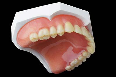 Denture Clinic services - denture relines