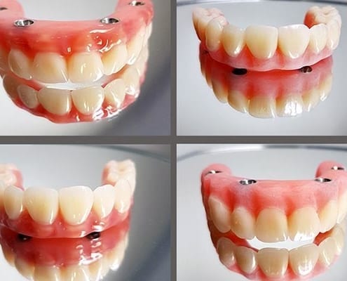 Dentures – bright and shining smiles