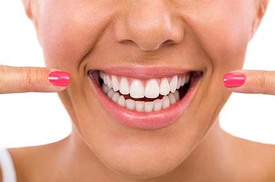 Rejuvenate services - gummy smile reduction