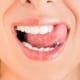 Oral piercings and dental health