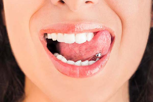 Oral piercings and dental health