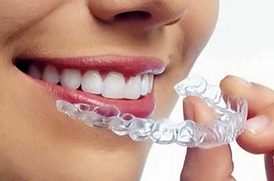 North Street Dental services - orthodontics