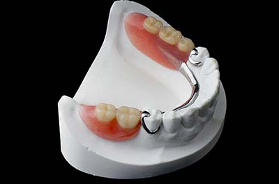 Denture Clinic services - partial dentures