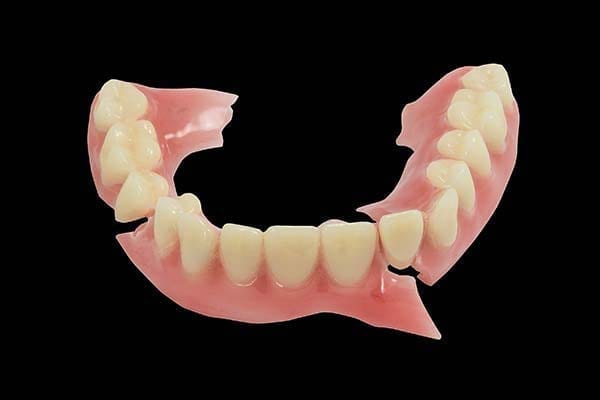 same day denture repairs, broken dentures