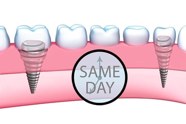 same day teeth