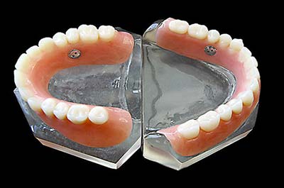 Denture Clinic services - suction dentures