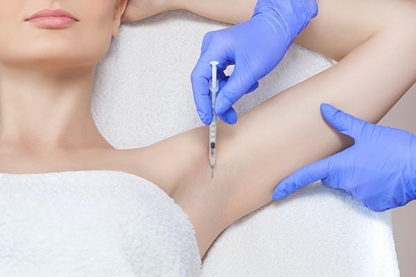Sweat reduction injections (Hyperhidrosis)