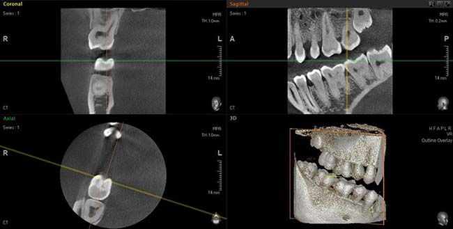 Vatech 3D dental scan 01