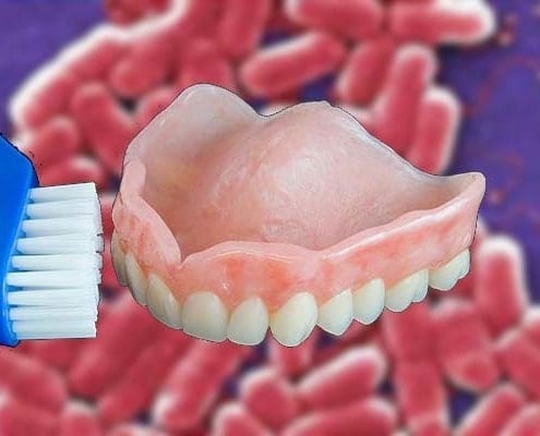 The dangers of dirty dentures