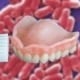 The dangers of dirty dentures