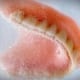Denture sore mouth