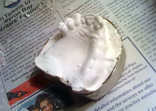 DIY clay dentures