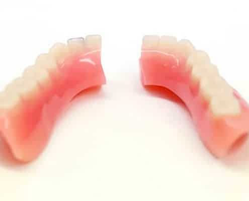 Do not risk DIY denture repair kits