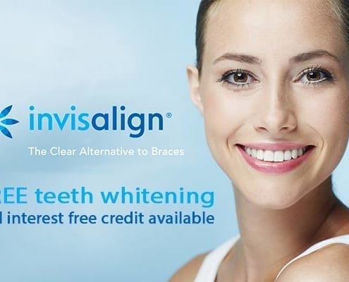 Invisalign offer blog