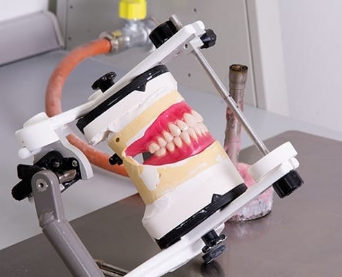 A special look from custom dentures