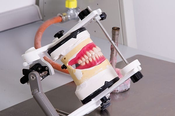 A special look from custom dentures