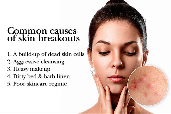 common causes of skin breakouts