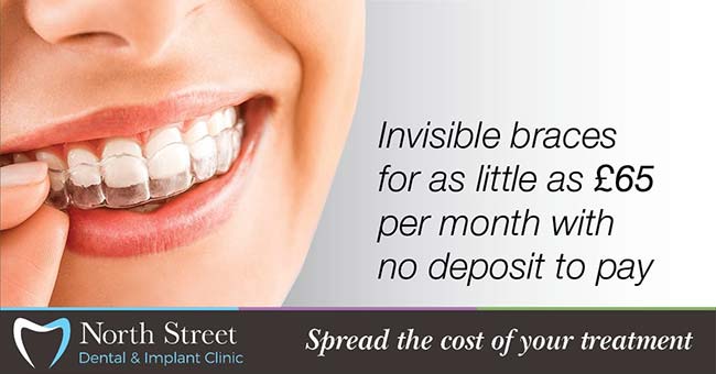 invisible braces from £65 per month