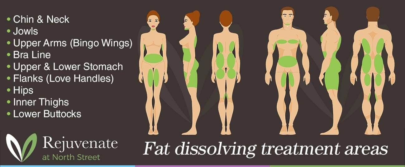 fat dissolving treatment areas