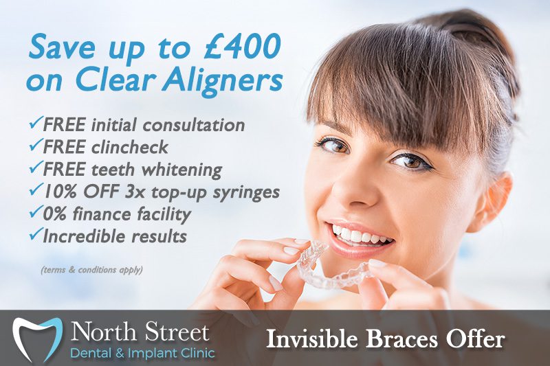 invisible braces offer
