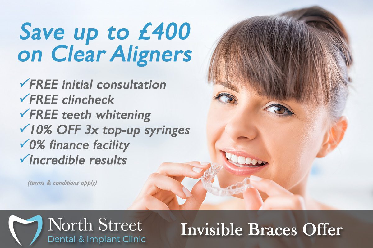 Invisible braces offer summer 2025