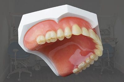 denture-relines-services North Street Dental services - fillings