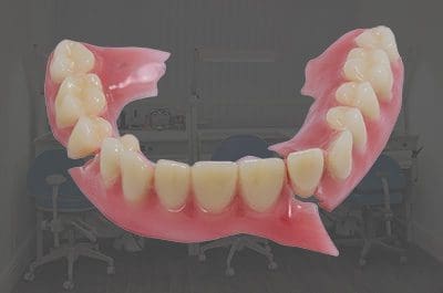 denture-repairs-services North Street Dental services - dental consultation