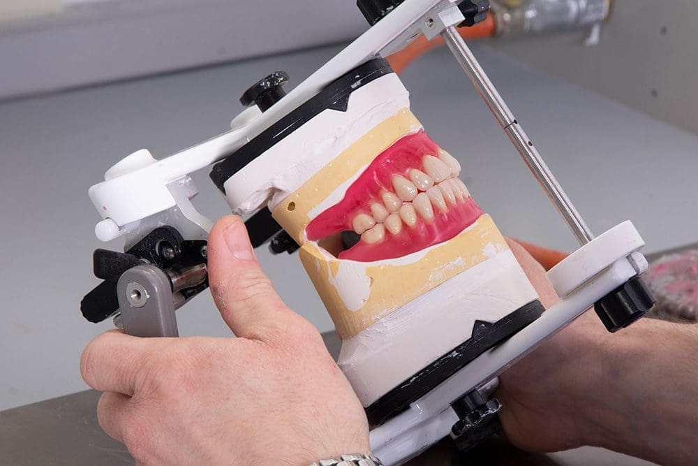 A special look from custom dentures