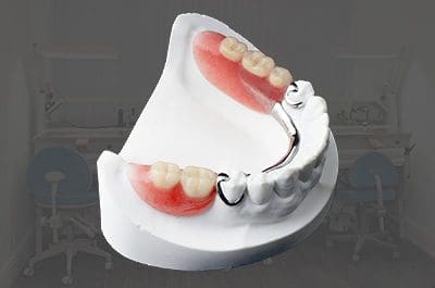partial-dentures-services North Street Dental services - fillings