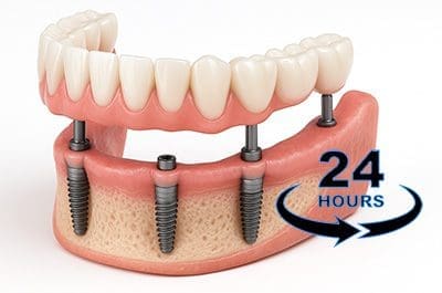 same-day-teeth-services North Street Dental services - dental finance
